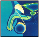 Cancer du testicule, on guérit presque toujours