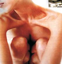 L'anorexie, c'est quoi ?